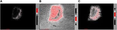 Quantitative Assessment of Angiogenesis in Skin Wound Healing by Multi-Optical Imaging Techniques